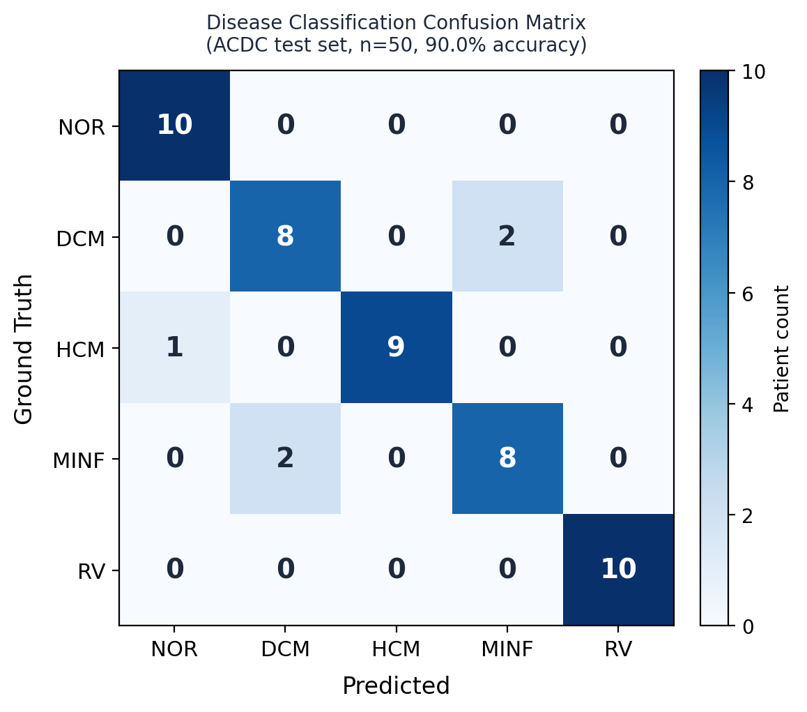 Confusion matrix